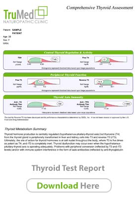 AdreThyroidnal Sample Report